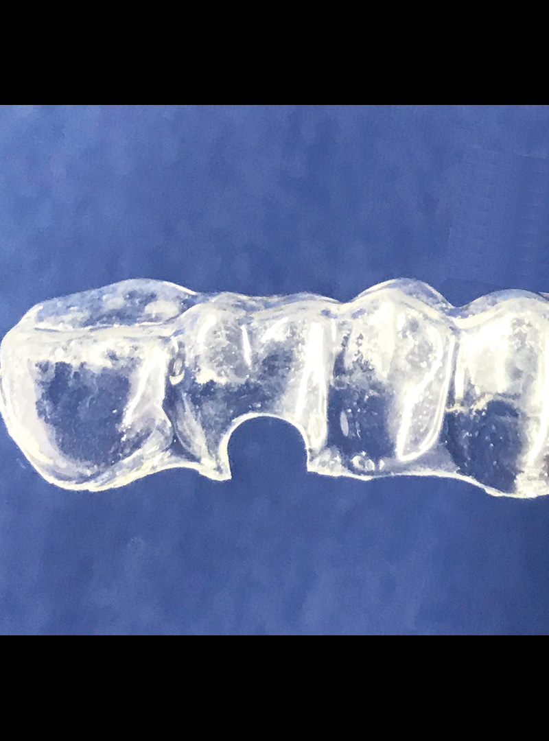 アライナープライヤー – 株式会社タスク